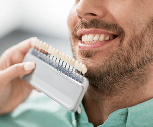 A man examines the shades for teeth whitening